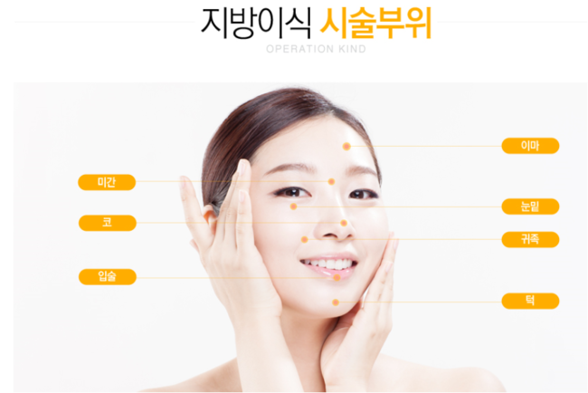 목동역지방이식 애교 얼굴 완성 관련 이미지 2