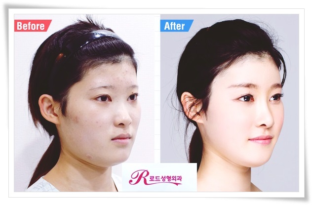 강서구코수술로 뚜렷한 이미지를 완성시키다! 관련 이미지 4