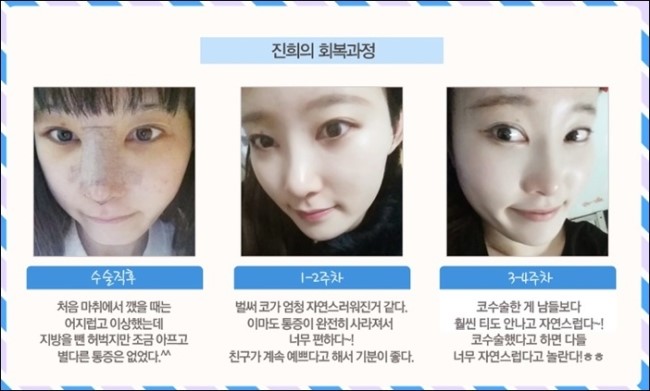 화곡역코성형 세련되게 로드에서 관련 이미지 1