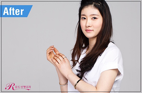 화곡동코성형 여기로 선택! 로드성형외과 관련 이미지 3