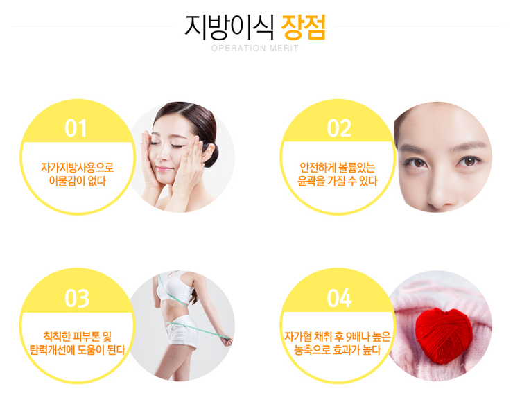 [까치산역성형외과 로드성형외과에서 알려드리는 지방이식 정보 ♬] 관련 이미지 3