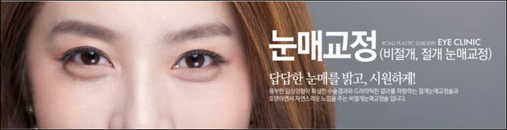 목동비절개눈매교정 선명한 변화 관련 이미지 1