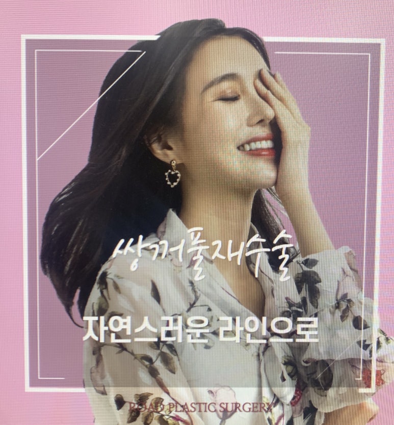 목동쌍꺼풀재수술 더이상 걱정하지마세요 관련 이미지 1
