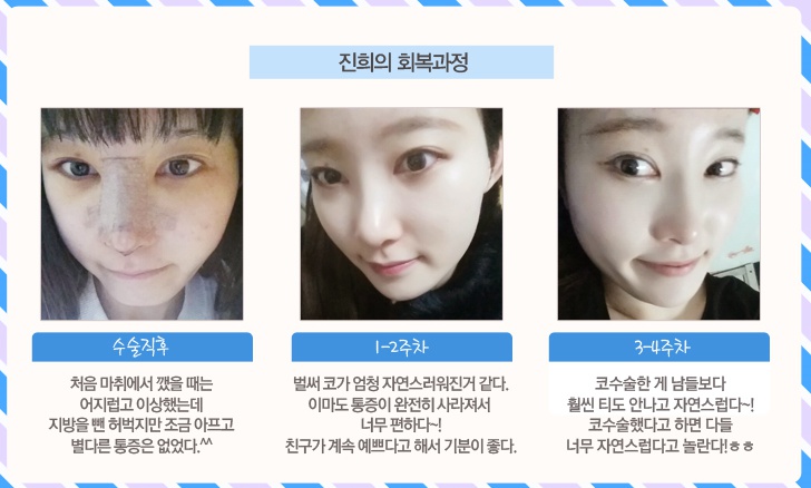까치산역코재수술 고난이도의 기술력 관련 이미지 3