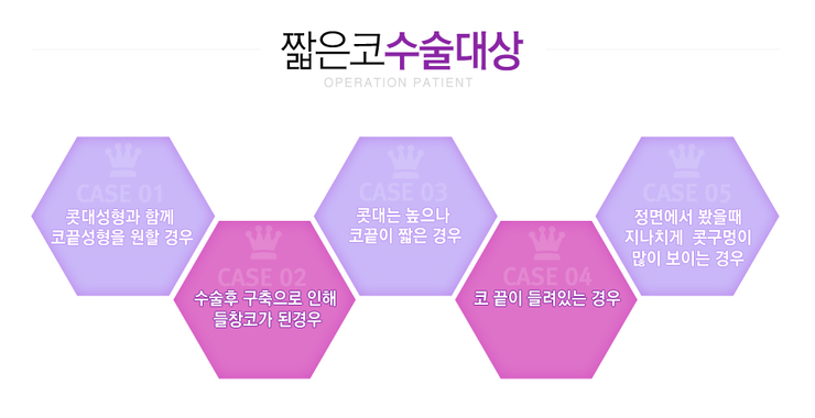 [화곡동성형외과 로드성형외과에서 알려드리는 짧은코성형 정보 ♬] 관련 이미지 2