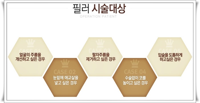 목동코필러로 아무도 몰라보게 관련 이미지 4