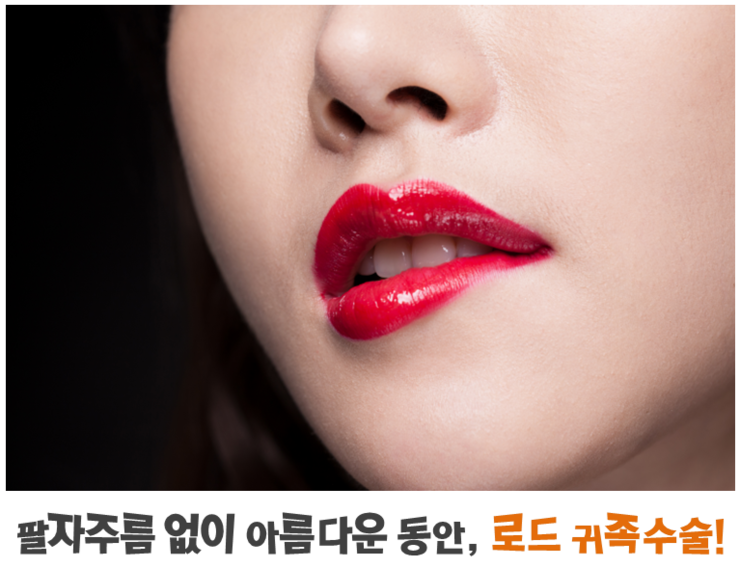 강서구귀족수술 ♬ 아이리스/로드성형외과 관련 이미지 3