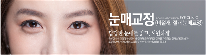신정역비절개눈매교정 잘하는곳 로드! 관련 이미지 1