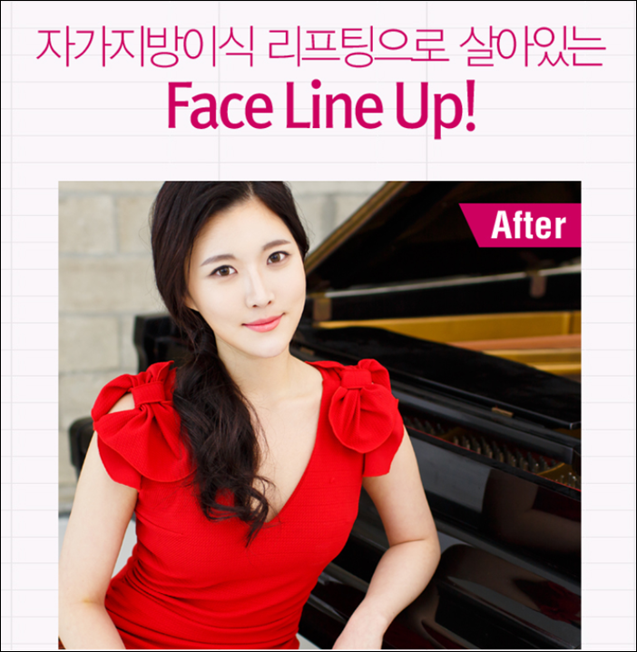 화곡동리프팅잘하는곳 로드를 선택! 관련 이미지 3