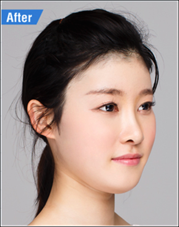 목동역코필러유명한곳 로드에서! 관련 이미지 4