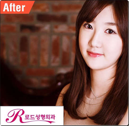 화곡역쌍커풀수술 우아하게 만들기 관련 이미지 3