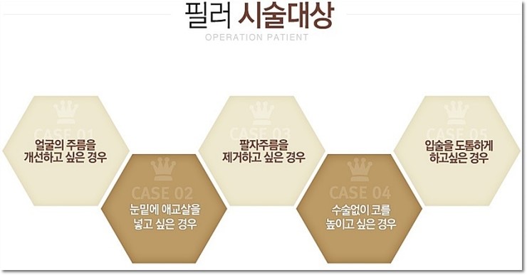 화곡역코필러 단기간에 효과보기 관련 이미지 4