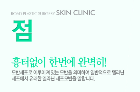 [화곡역성형외과 로드성형외과에서 알려드리는 점빼기 정보 ♬] 관련 이미지 1