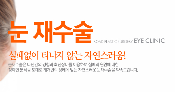 [화곡동성형외과 로드성형외과에서 알려드리는 눈재수술 정보 ♬] 관련 이미지 2