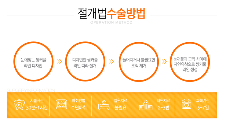 [화곡역성형외과 로드성형외과에서 알려드리는 눈성형 정보 ♬] 관련 이미지 4