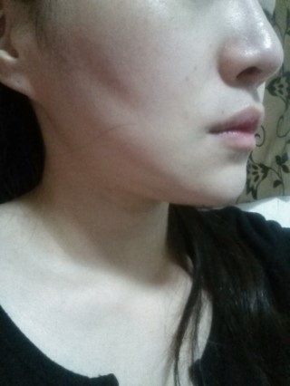 [리나 관련 이미지 9