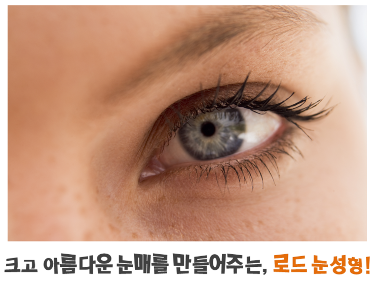 ​[로드성형외과/아이리스성형외과] 강서눈성형잘하는곳 추천 ♬ 관련 이미지 3