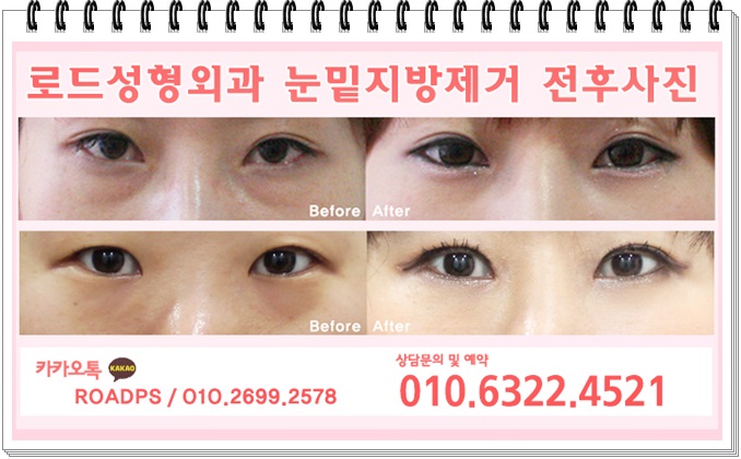 목동역성형외과 로드에서 아름다움을 입히다 관련 이미지 3