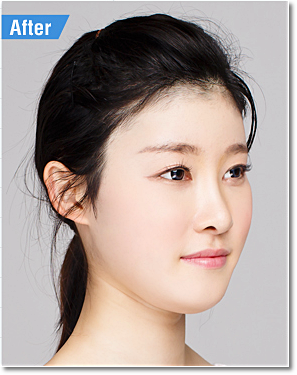 목동코필러 안심되는 이곳 관련 이미지 4