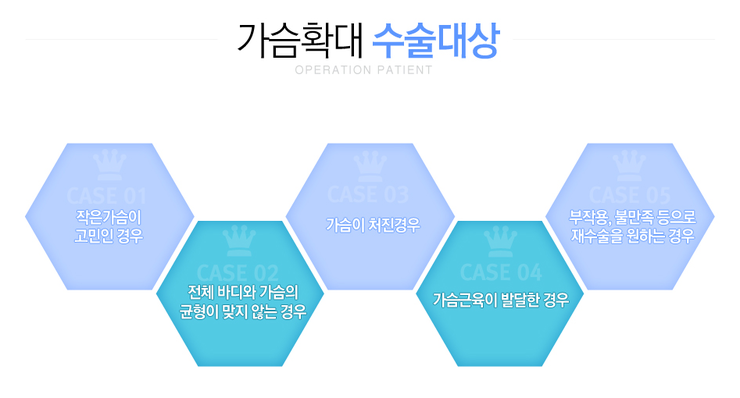 [구.아이리스성형외과 로드성형외과에서 알려드리는 가슴성형 정보 ♬] 관련 이미지 2