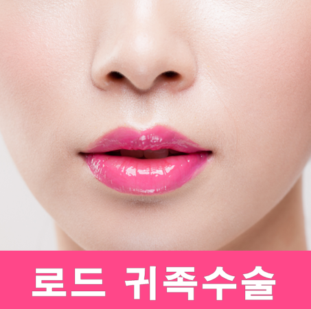 강서구귀족수술 ♬ 아이리스/로드성형외과 관련 이미지 1