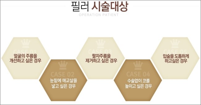 마곡지구필러 자연스러운 볼륨감 관련 이미지 2