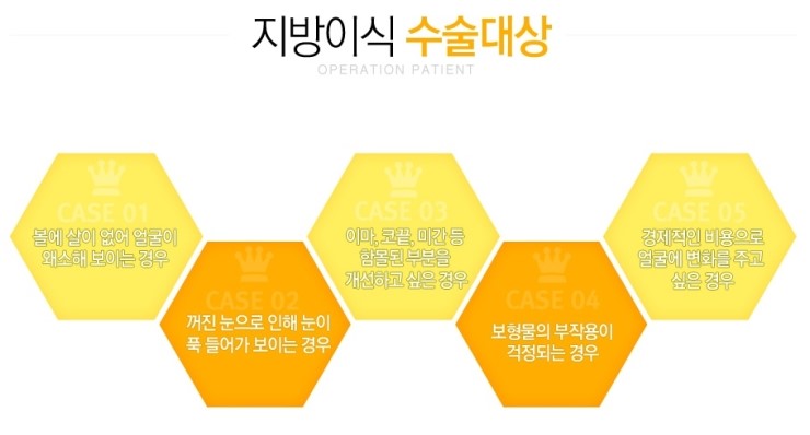 까치산역지방이식 아무도모르게 변신 관련 이미지 3