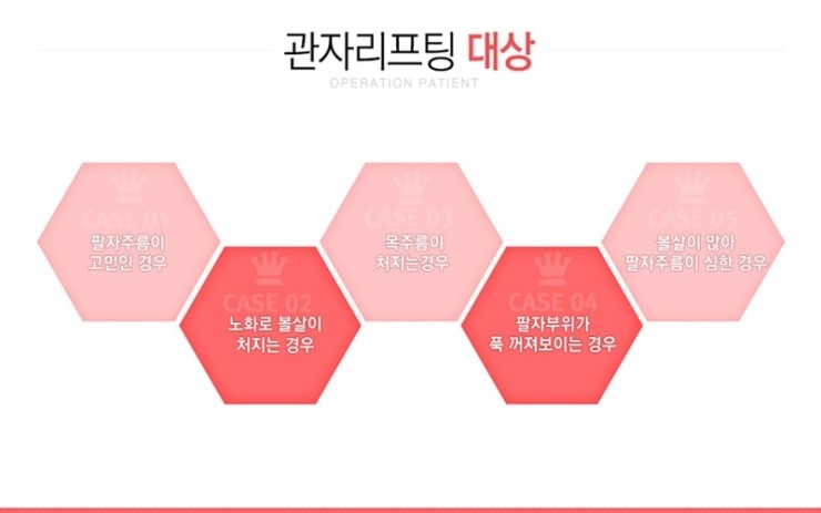 목동리프팅 탱탱한 피부를 원한다면 관련 이미지 2