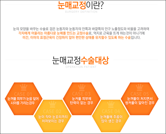 신정역비절개눈매교정 잘하는곳 로드! 관련 이미지 2