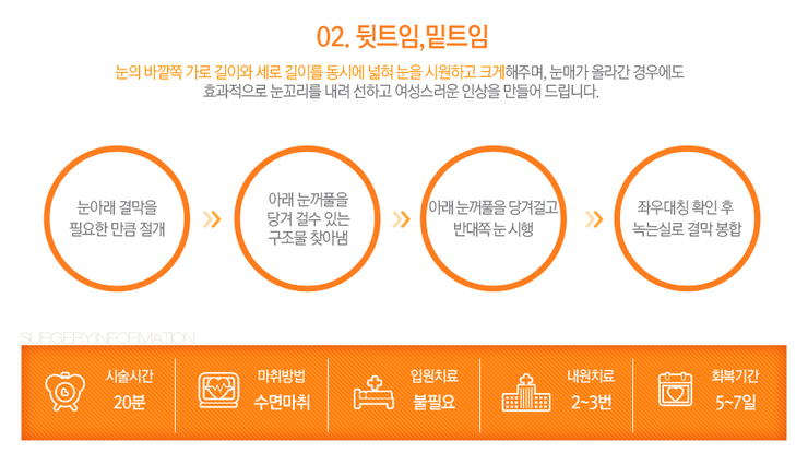 [까치산성형외과 로드성형외과에서 알려드리는 트임성형 정보 ♬] 관련 이미지 5