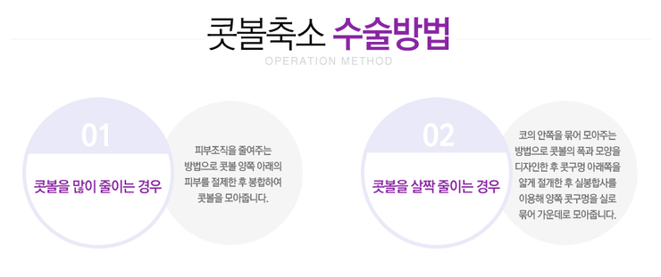 [까치산성형외과 로드성형외과에서 알려드리는 콧볼축소 정보 ♬] 관련 이미지 3