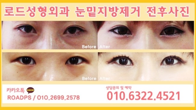 화곡역성형외과 로드에서 꿈을 실현하다 관련 이미지 1