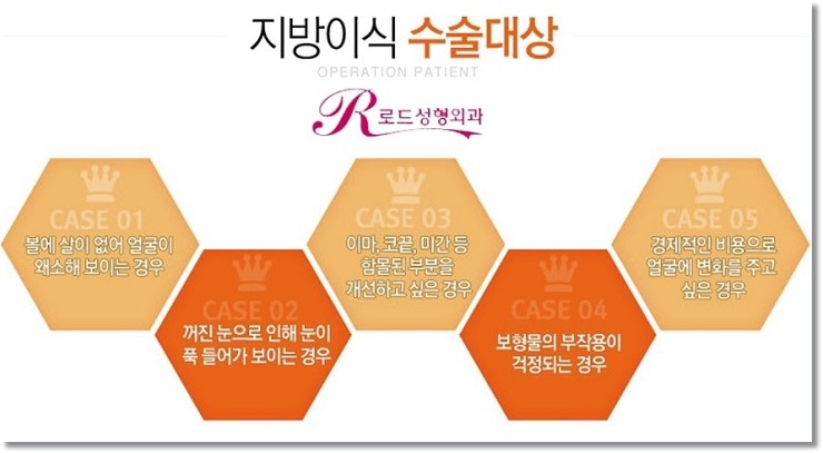 까치산역지방이식잘하는곳 여기가 안전 관련 이미지 3