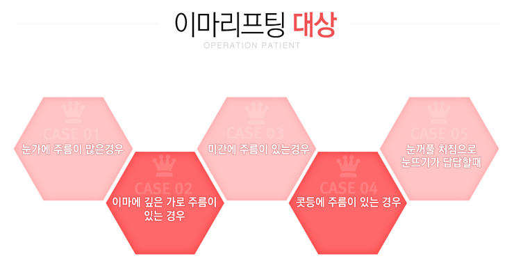 [화곡동성형외과 로드성형외과에서 알려드리는 이마리프팅 정보 ♬] 관련 이미지 2