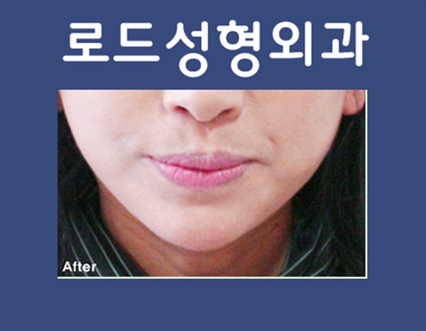 신정역리프팅 젊음을 더하는 로드! 관련 이미지 2
