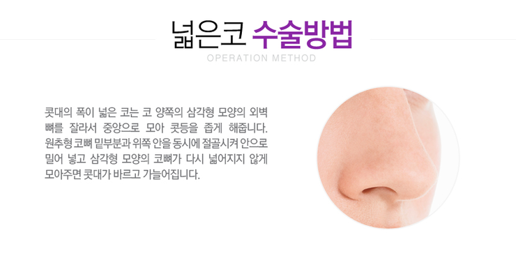 [화곡역성형외과 로드성형외과에서 알려드리는 넓은코성형 정보 ♬] 관련 이미지 3