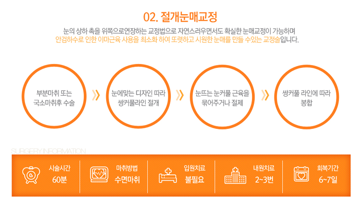 [까치산성형외과 로드성형외과에서 알려드리는 눈매교정 정보 ♬] 관련 이미지 5