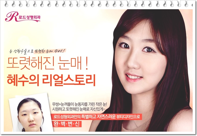 목동눈성형 반짝 빛나게 관련 이미지 4