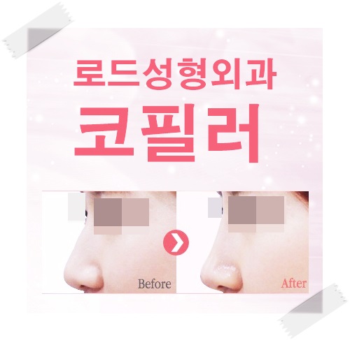 까치산역코필러 기분 좋게 해결 관련 이미지 2