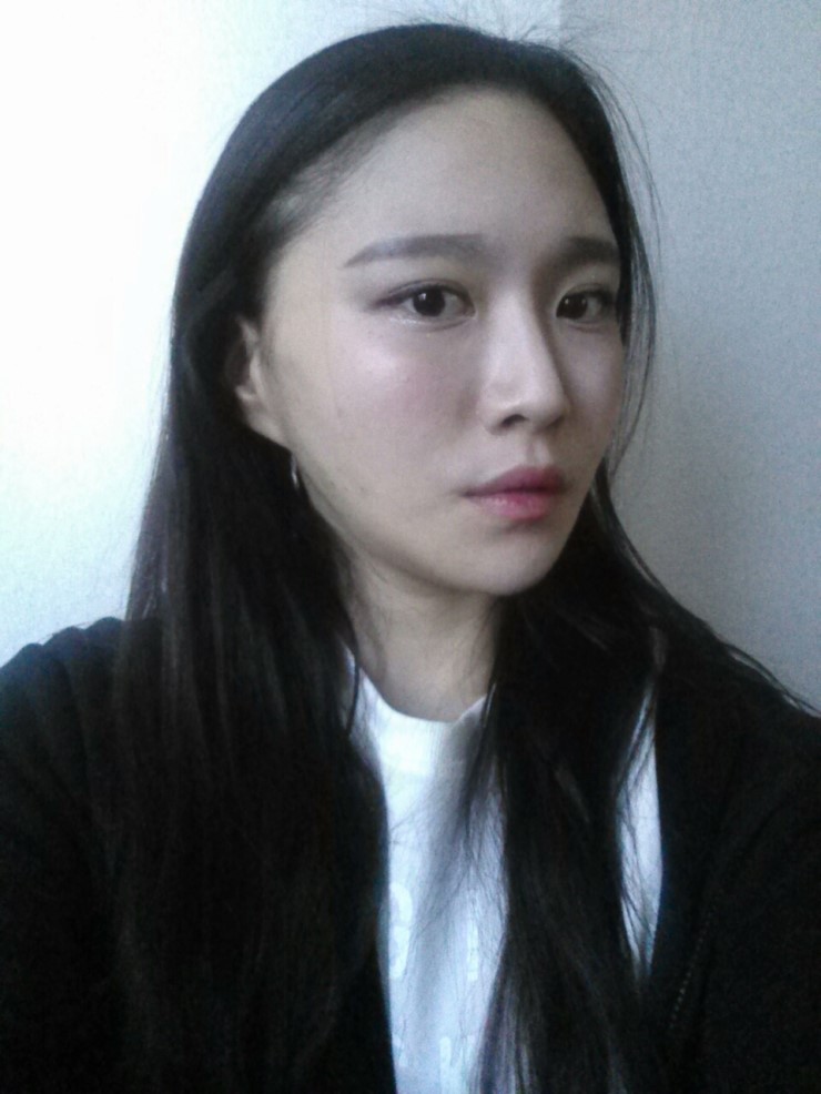 [로드성형외과] 리나의 볼리프팅, 볼지방이식, 앞광대지방이식 후기! 관련 이미지 3