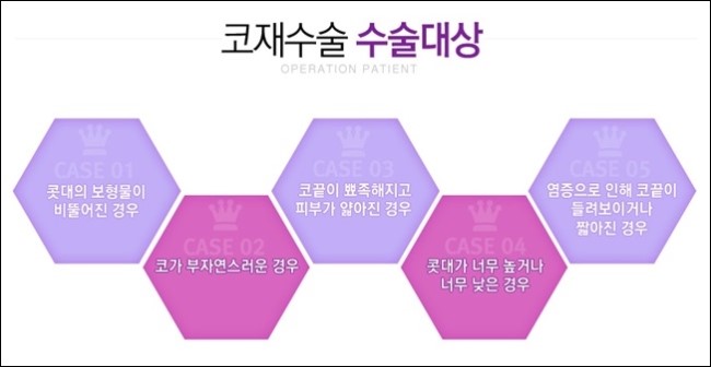 화곡역코성형 세련되게 로드에서 관련 이미지 4