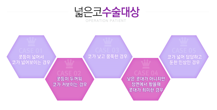 [화곡역성형외과 로드성형외과에서 알려드리는 넓은코성형 정보 ♬] 관련 이미지 2