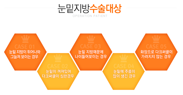 [화곡동성형외과 로드성형외과에서 알려드리는 눈밑지방재배치 정보 ♬] 관련 이미지 2