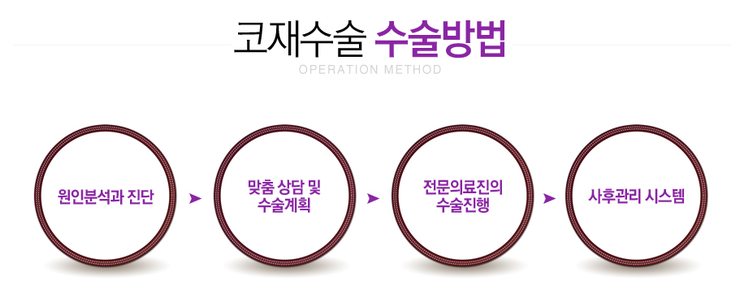 [까치산역성형외과 로드성형외과에서 알려드리는 코재수술 정보 ♬] 관련 이미지 3