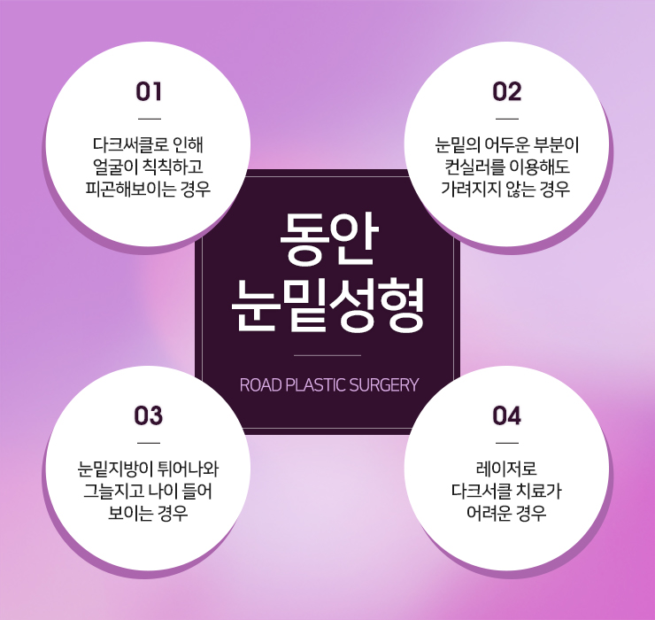 강서구눈밑지방제거 다크서클도 깨끗하게 관련 이미지 3