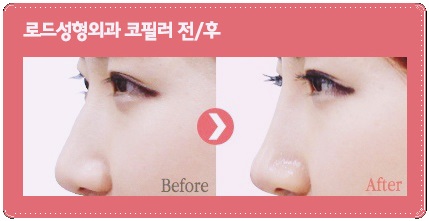 화곡역코필러 생기를 불어넣다 관련 이미지 3