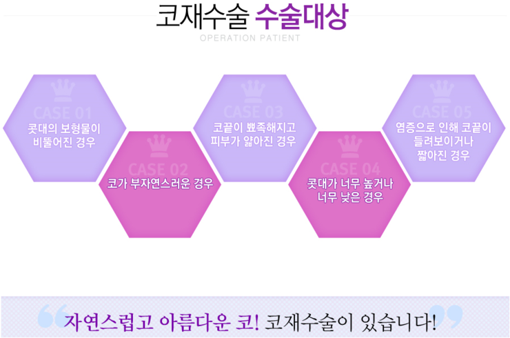 강서구코재수술잘하는곳 안전하게 선택 관련 이미지 2