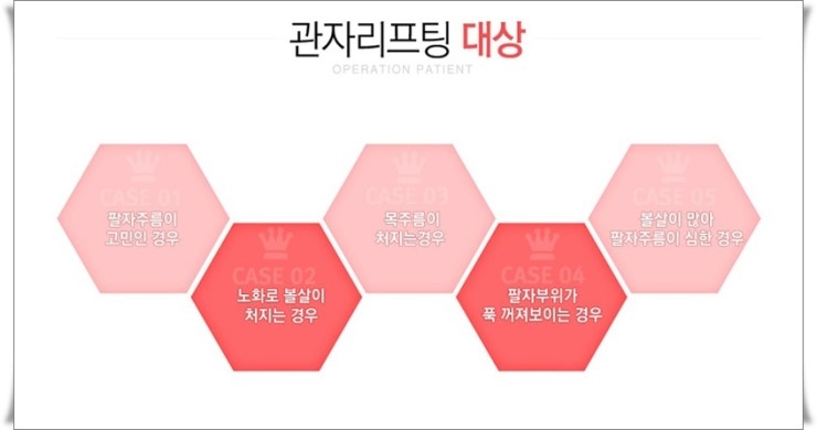 신정역리프팅 로드성형외과에서 해결 관련 이미지 2