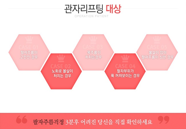 강서구리프팅 감출 수 없는 미모 관련 이미지 3