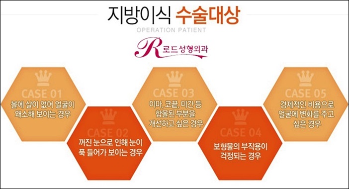 목동역지방이식 잘하는곳 로드 선택 관련 이미지 4